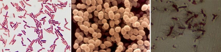 E. coli, fekal enterokok ve proteus, kronik bakteriyel prostatitin ana etken maddeleridir. 