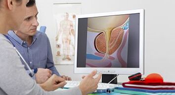Bir erkekte prostatit teşhisi
