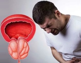 Belirtileri kronik prostatit erkeklerde