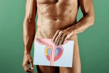 Akut bulaşıcı prostatit